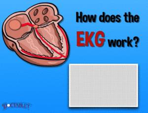 How does the EKG work? - Doctablet®