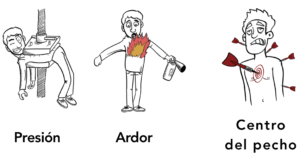 La angina se siente como presión o ardor en el centro del pecho.