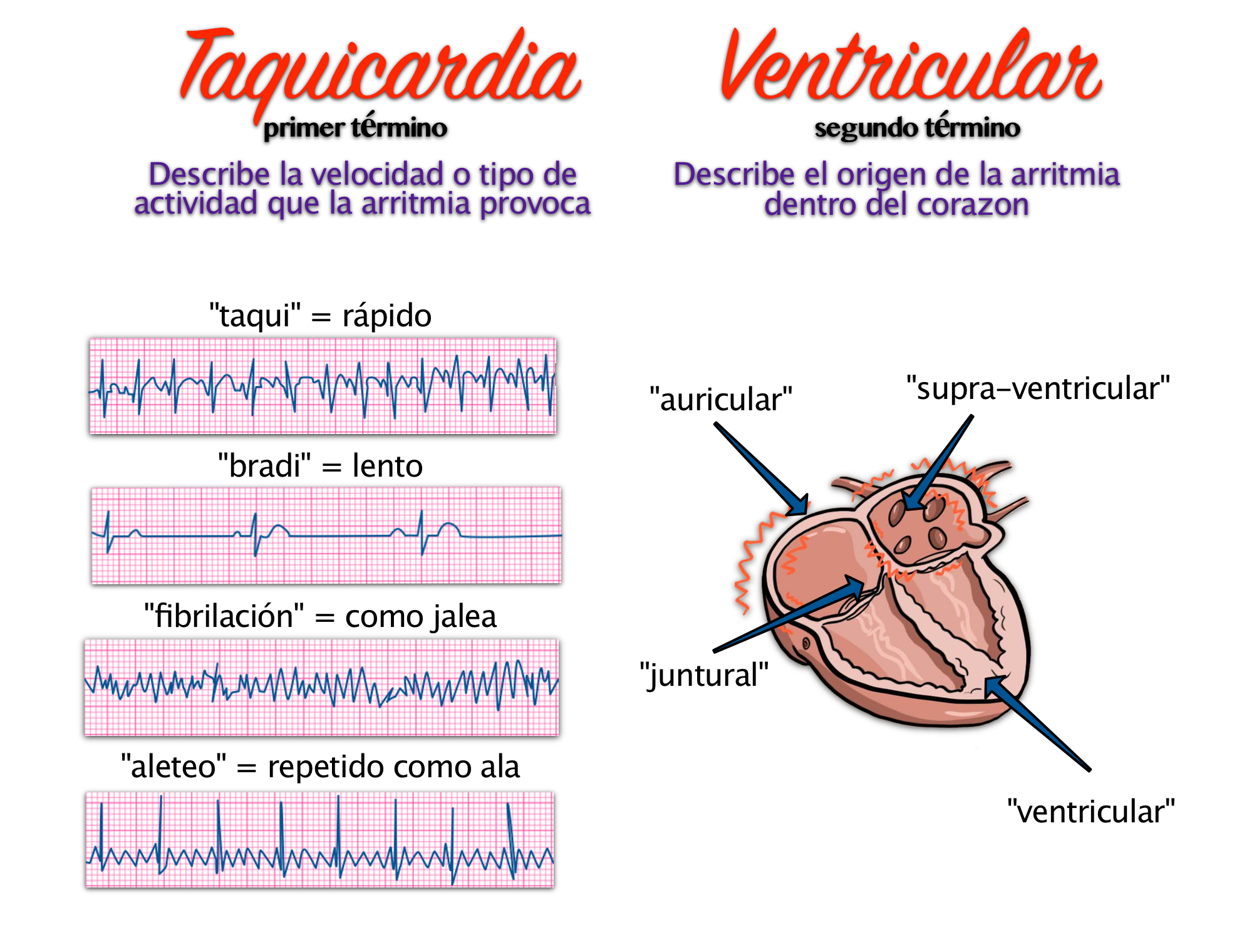 Arritmia, Ritmos Anormales En El Corazón - Doctablet®