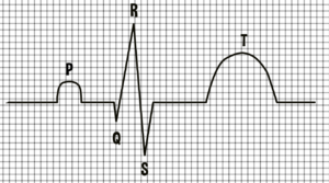Ondas del ECG