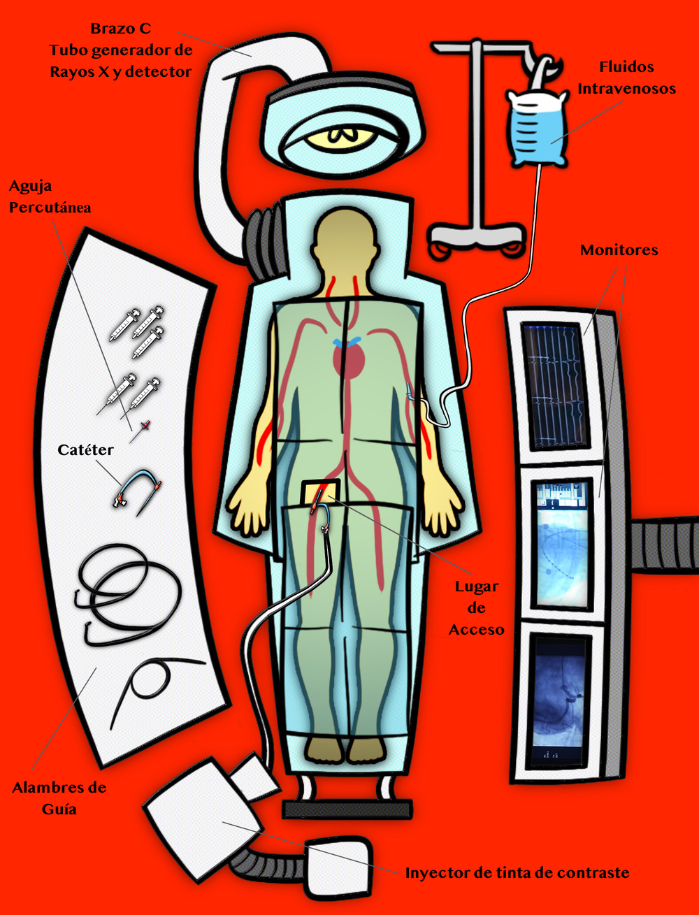 Diagrama del laboratorio de cateterismo cardiaco - Doctablet Español