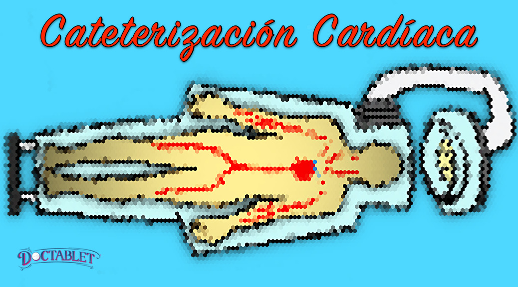 Cateterización Cardíaca