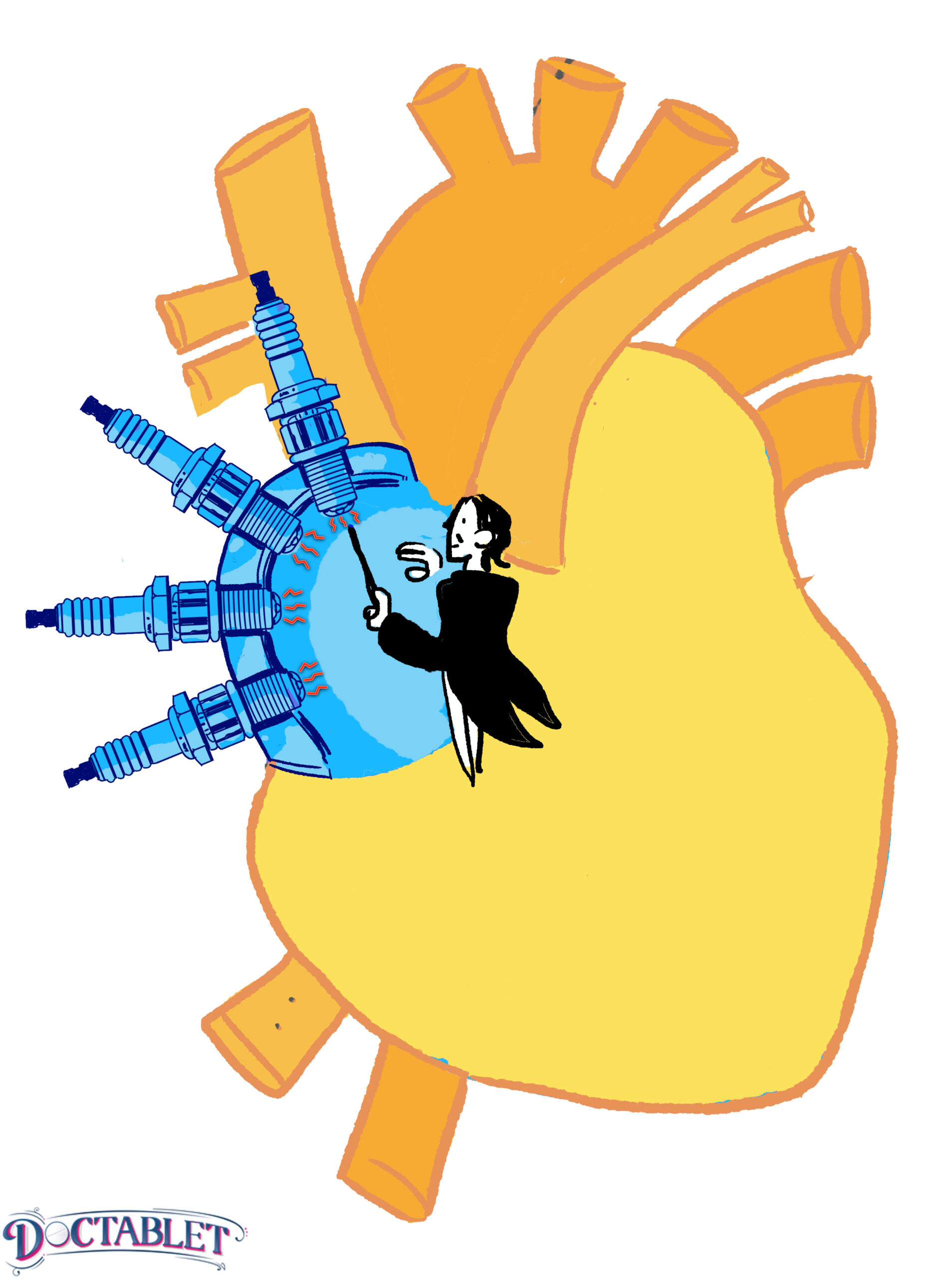 El nodo sinusal, conductor de bujias - Doctablet