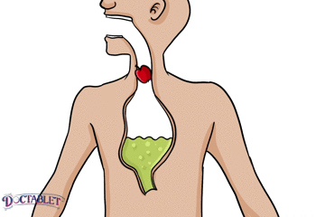 La cantidad de energía obtenida de la digestión de una cantidad determinada de alimentos se llama una caloría. 