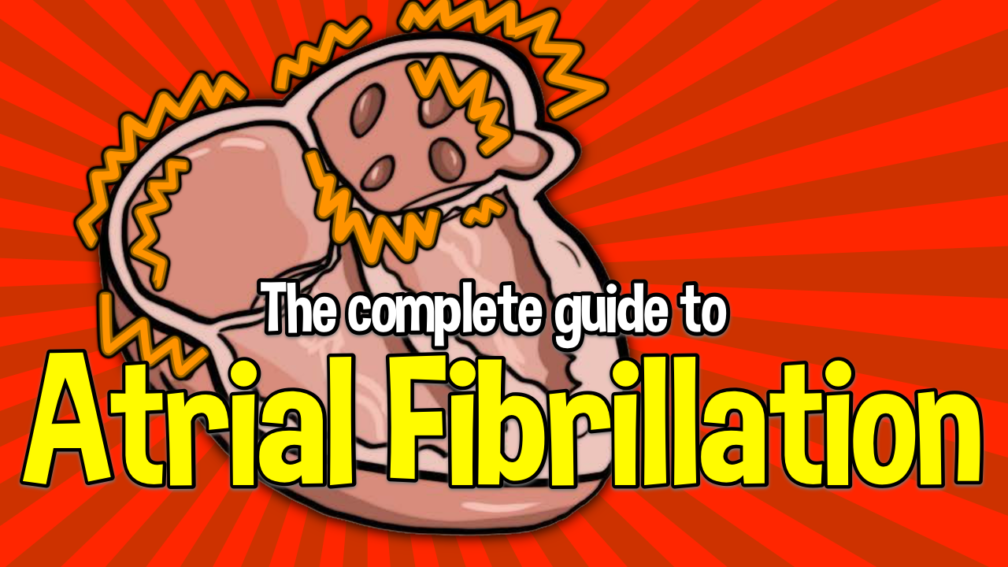 The Complete Guide to Atrial Fibrillation