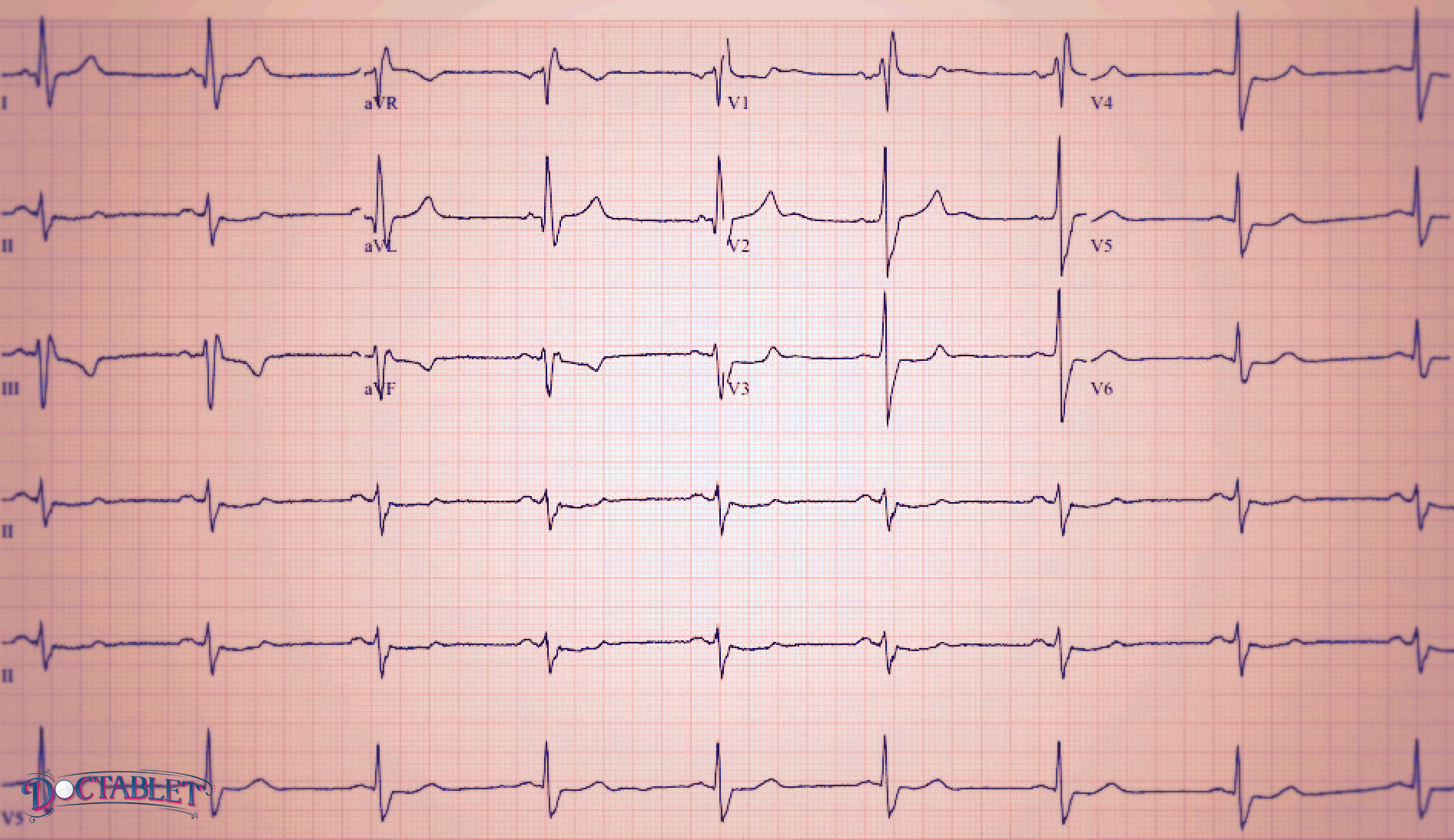 ecg-ekg-how-does-the-ecg-work-doctablet