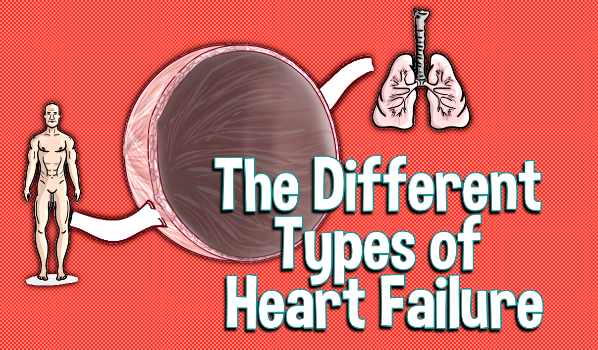 diastolic-heart-failure-systolic-heart-failure-doctablet