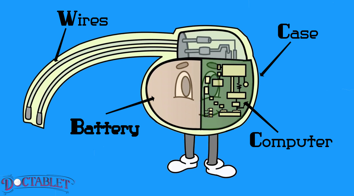 The parts that make up a pacemaker
